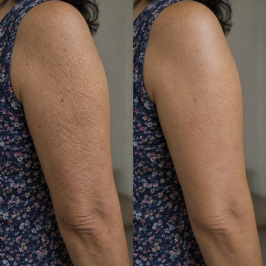Primer plano de la parte de atrás del brazo: a la izquierda la piel arrugada y apagada, a la derecha lisa y uniforme