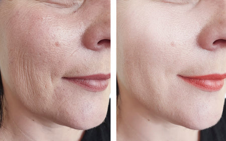 120519289-woman-wrinkles-face-before-and-after-beautician_1_792b32e4-2c98-4102-978a-e5ecbf3fb0bb.jpg