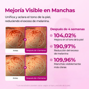 CALCI LIFT™ Rutina Intensiva de Elasticidad y Efecto Lifting