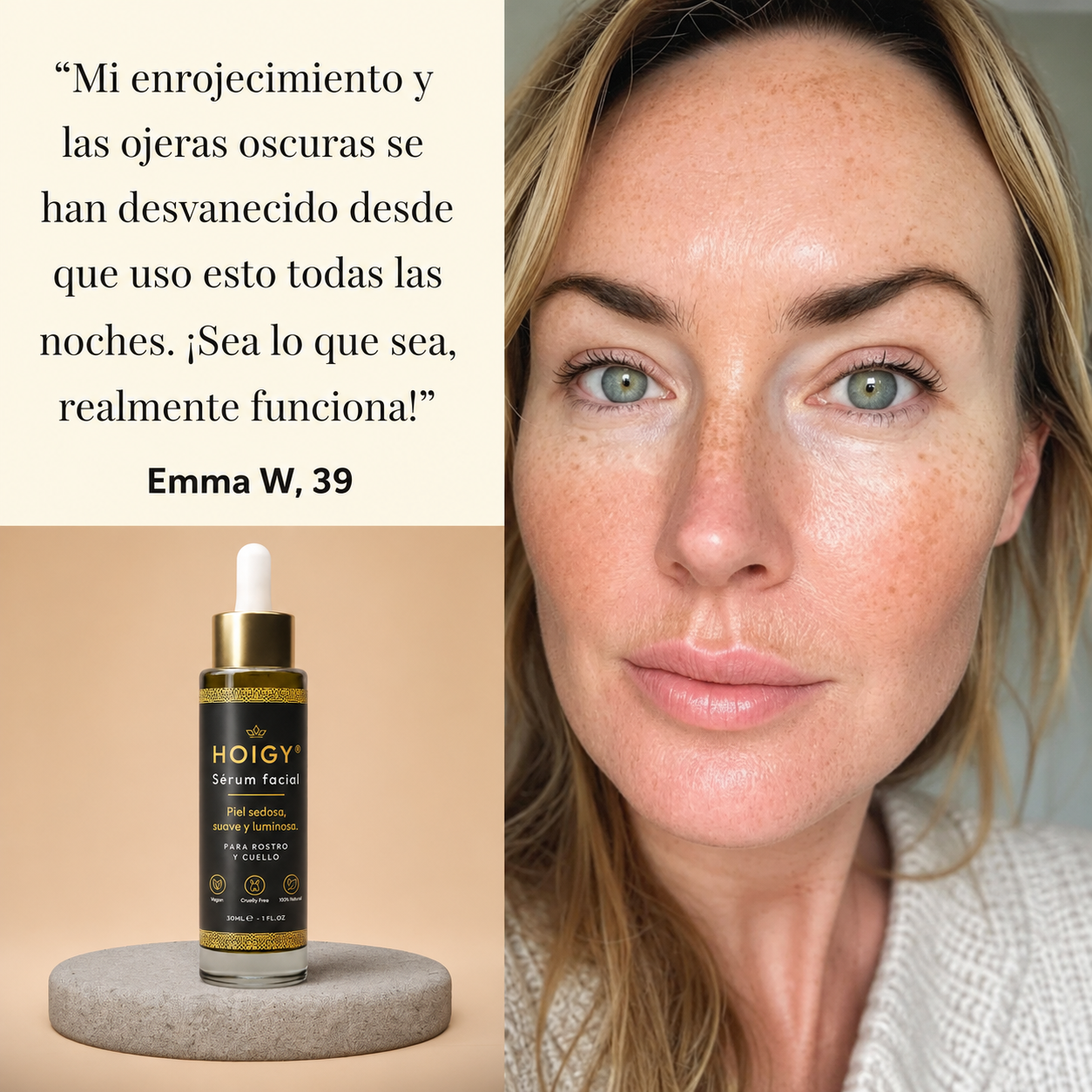 HOIGY® Sérum Facial-30ml