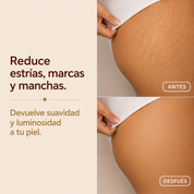 ELIXIA® Aceite Corporal Mágico