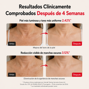 Sérum Antimanchas EQQUALBERRY® · Cuello y Escote