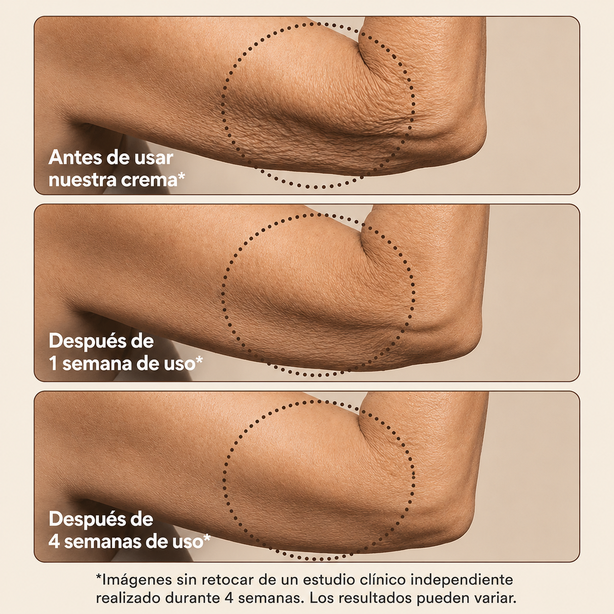 EQQUALBERRY® Crema Corporal Reafirmante Intensiva