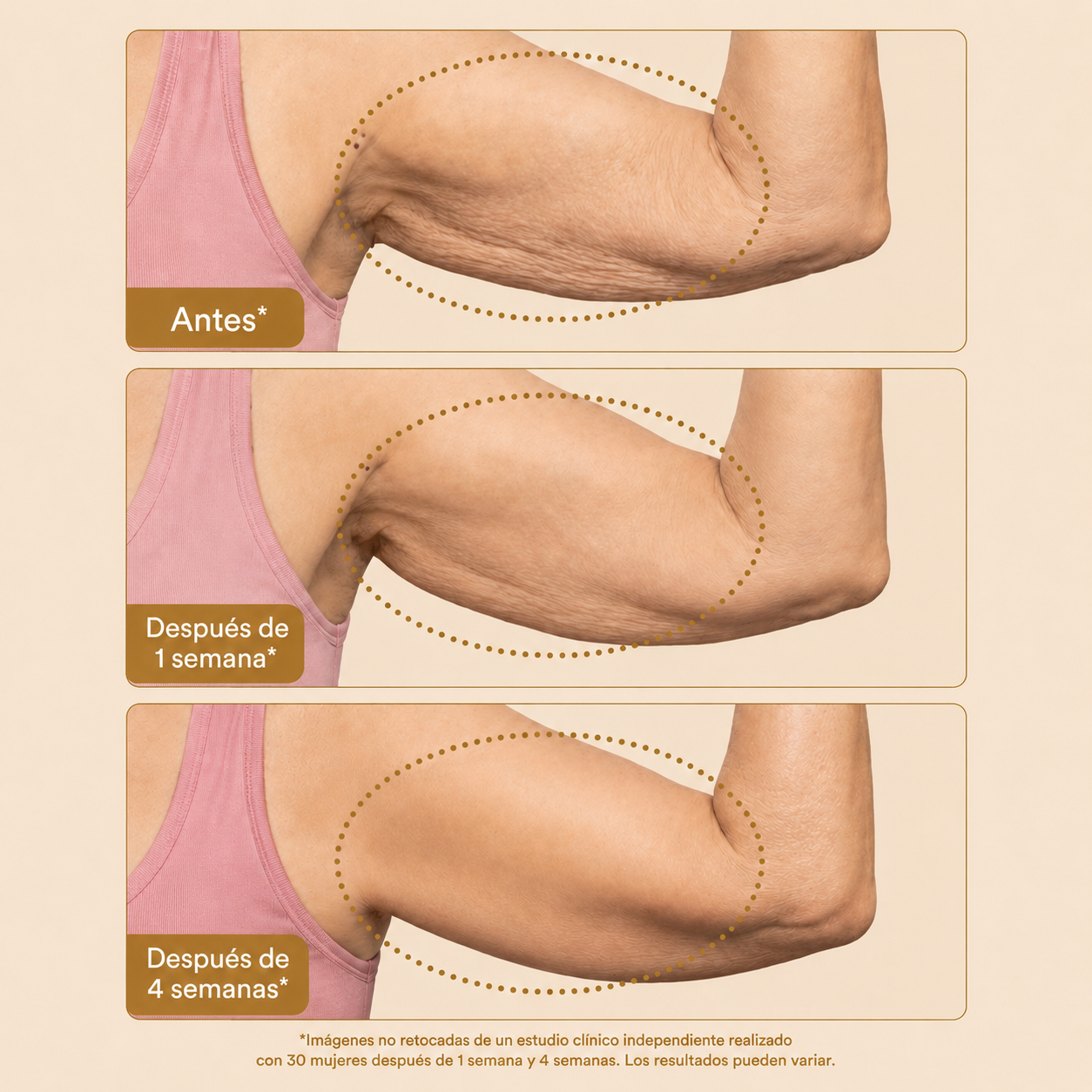 LUXMA® Aceite Reafirmante de Brazos
