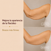 ELIXIA® Aceite Corporal Mágico