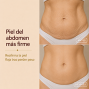 ELIXIA® Aceite Corporal Mágico