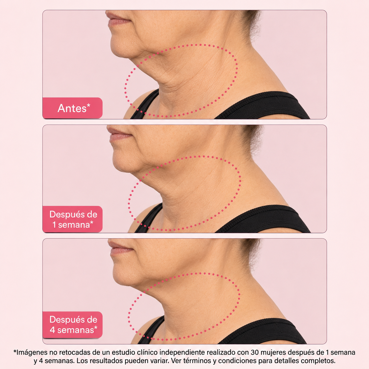 SISTEMA DOBLE NAD⁺® Reafirmante de Cuello y Papada