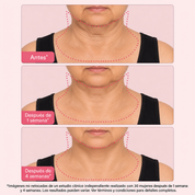 SISTEMA DOBLE NAD⁺® Reafirmante de Cuello y Papada