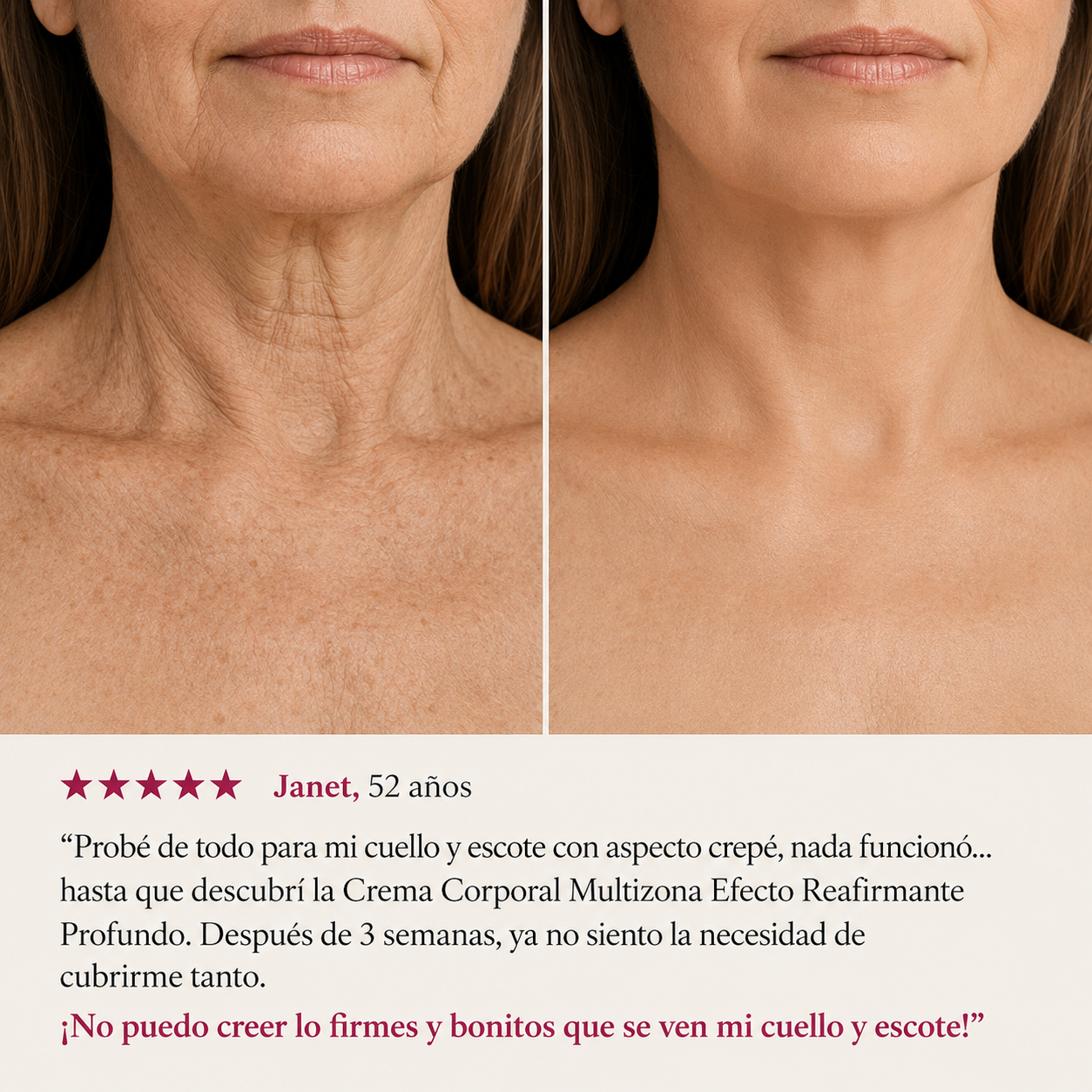 EQQUALBERRY® Crema Reafirmante de Cuello y Papada