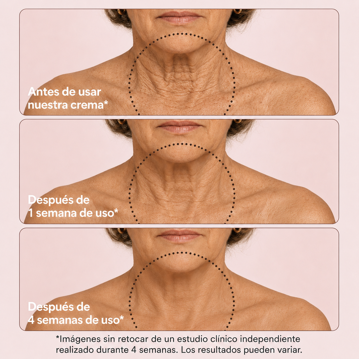 SISTEMA DOBLE NAD⁺® Reafirmante de Cuello y Papada