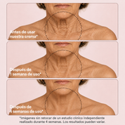 SISTEMA DOBLE NAD⁺® Reafirmante de Cuello y Papada