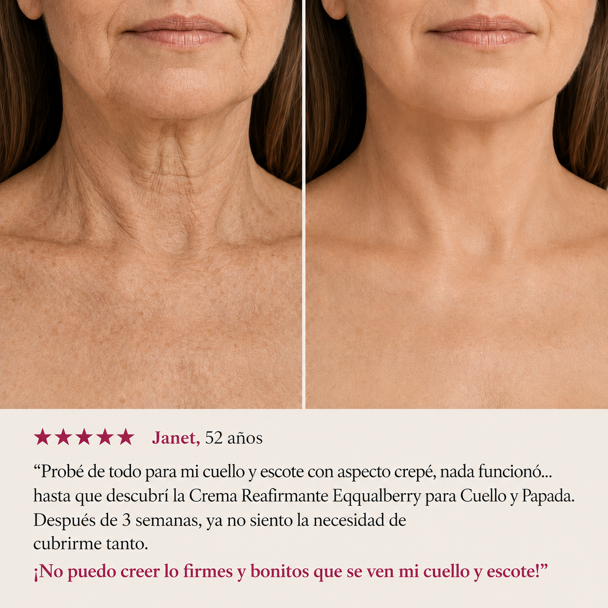 SISTEMA DOBLE NAD⁺® Reafirmante de Cuello y Papada