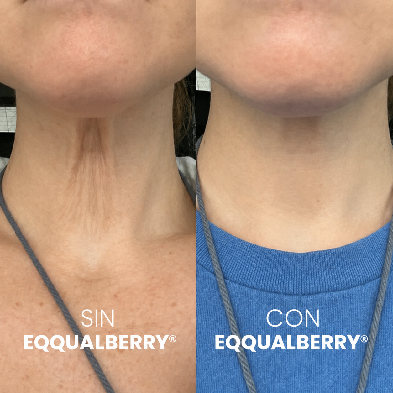 SISTEMA DOBLE NAD⁺® Reafirmante de Cuello y Papada