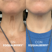SISTEMA DOBLE NAD⁺® Reafirmante de Cuello y Papada