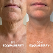 Crema EQQUALBERRY® Reafirmante de Cuello y Papada