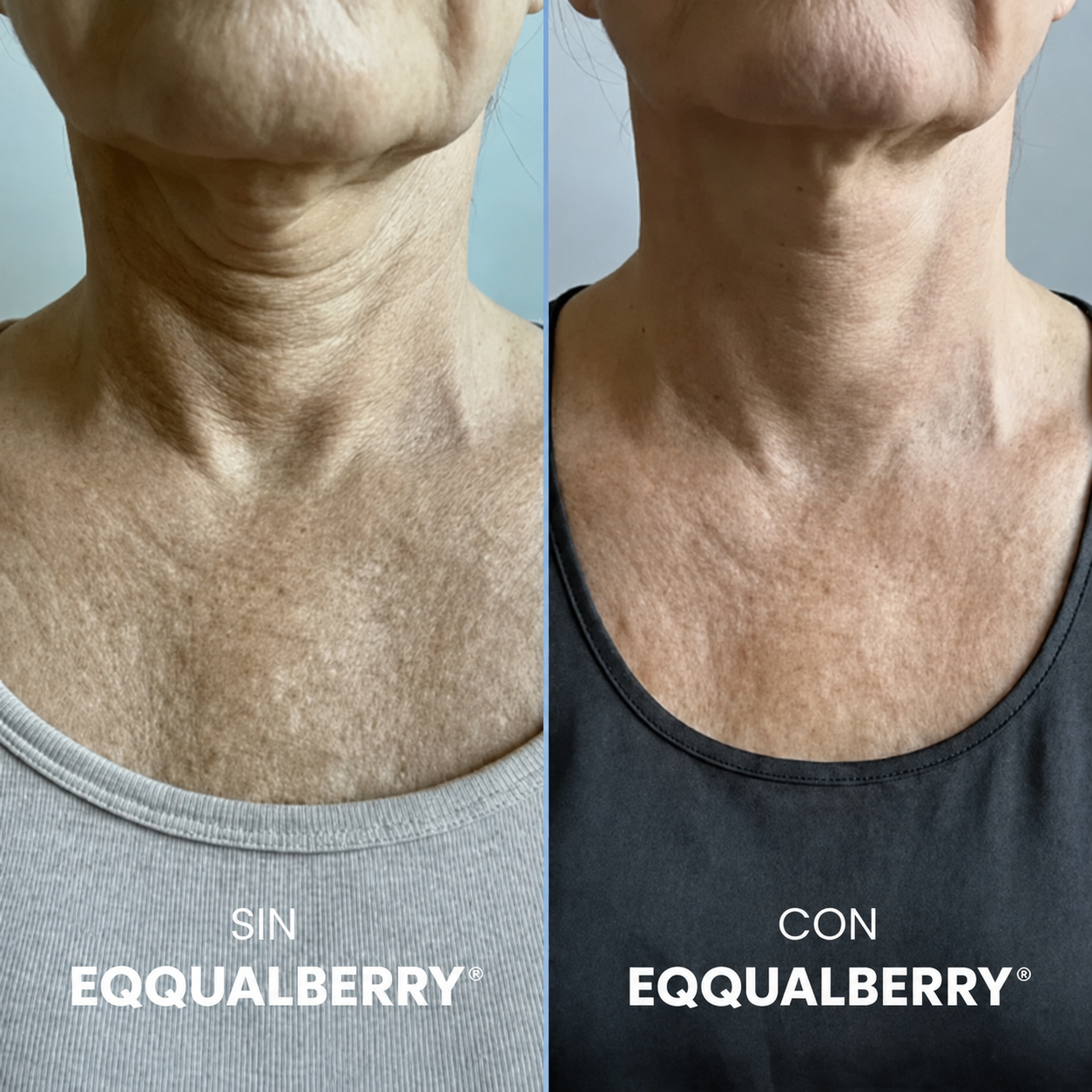 Crema EQQUALBERRY® Reafirmante de Cuello y Papada