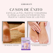 Mascarilla Exfoliante para pies (Regalo)