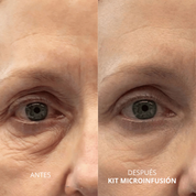 Kit de Microinfusión Facial: Rejuvenecimiento y Firmeza