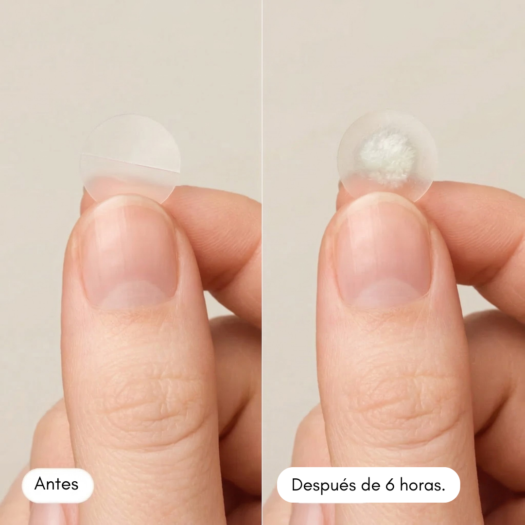 Parches Antiacné Efecto Rápido