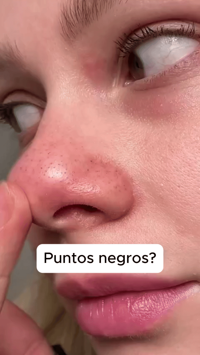 G2_AMPOLLAS_ARROZ_1_1.gif