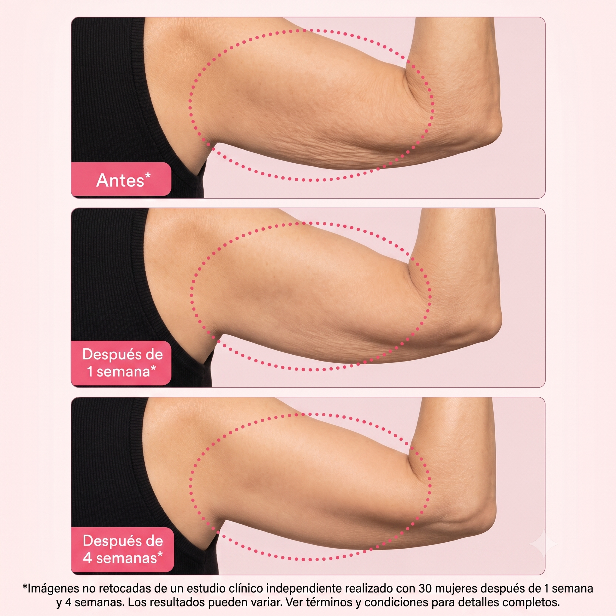 EQQUALBERRY® Crema Corporal Reafirmante Intensiva