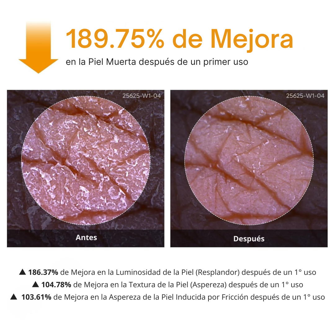Spray Corporal Exfoliante Antimanchas con Ácido Kójico y Cúrcuma