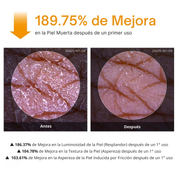 Spray Corporal Exfoliante Antimanchas con Ácido Kójico y Cúrcuma