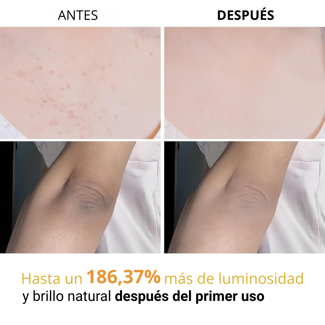 Spray Corporal Exfoliante Antimanchas con Ácido Kójico y Cúrcuma
