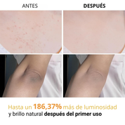 Spray Corporal Exfoliante Antimanchas con Ácido Kójico y Cúrcuma
