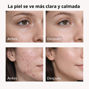 Sérum Iluminador y Antimanchas con Centella Asiática