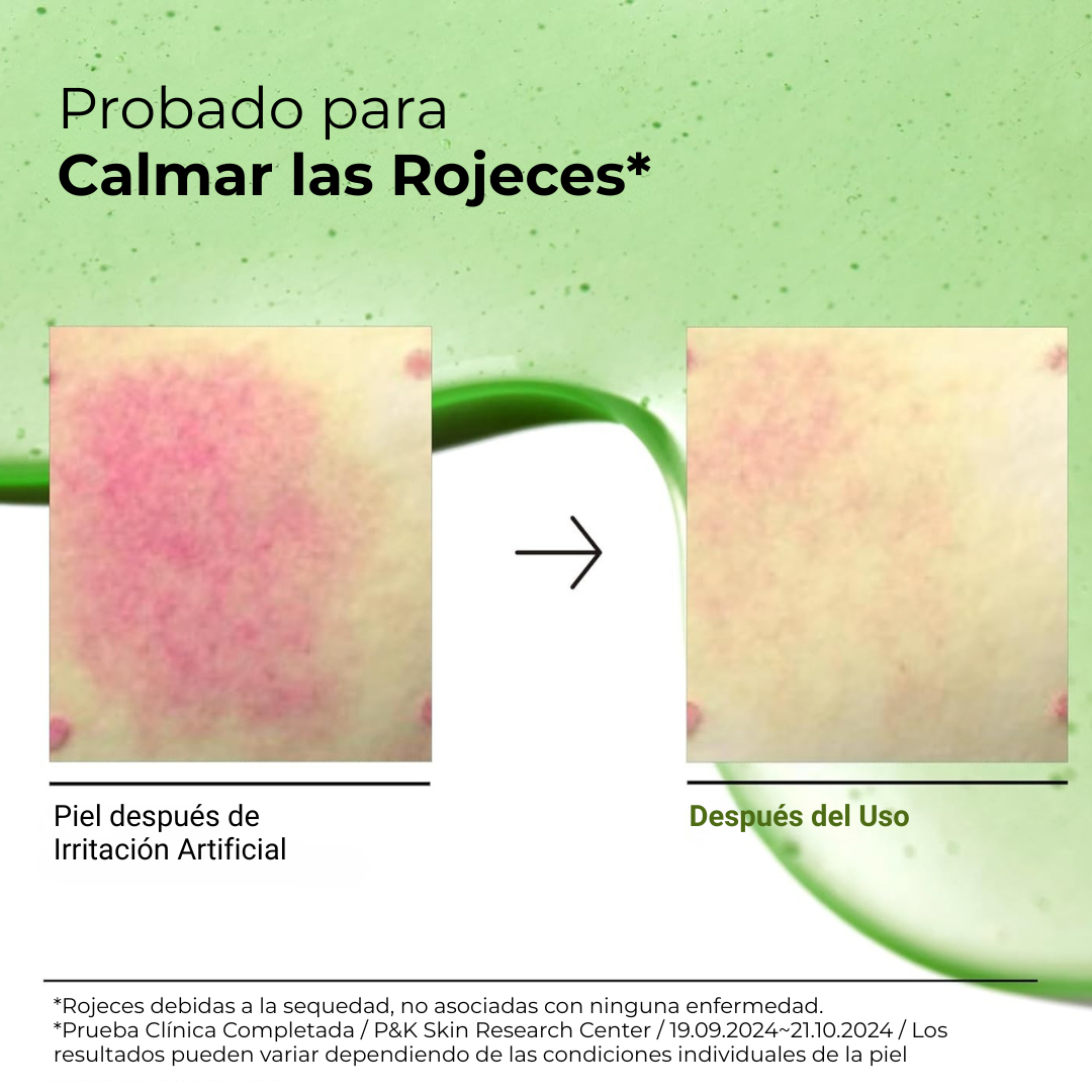 Sérum Calmante Anti-Rojez Azelaico 10% con Hialurónico