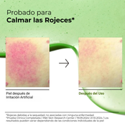 Sérum Calmante Anti-Rojez Azelaico 10% con Hialurónico