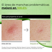 Sérum Calmante Anti-Rojez Azelaico 10% con Hialurónico