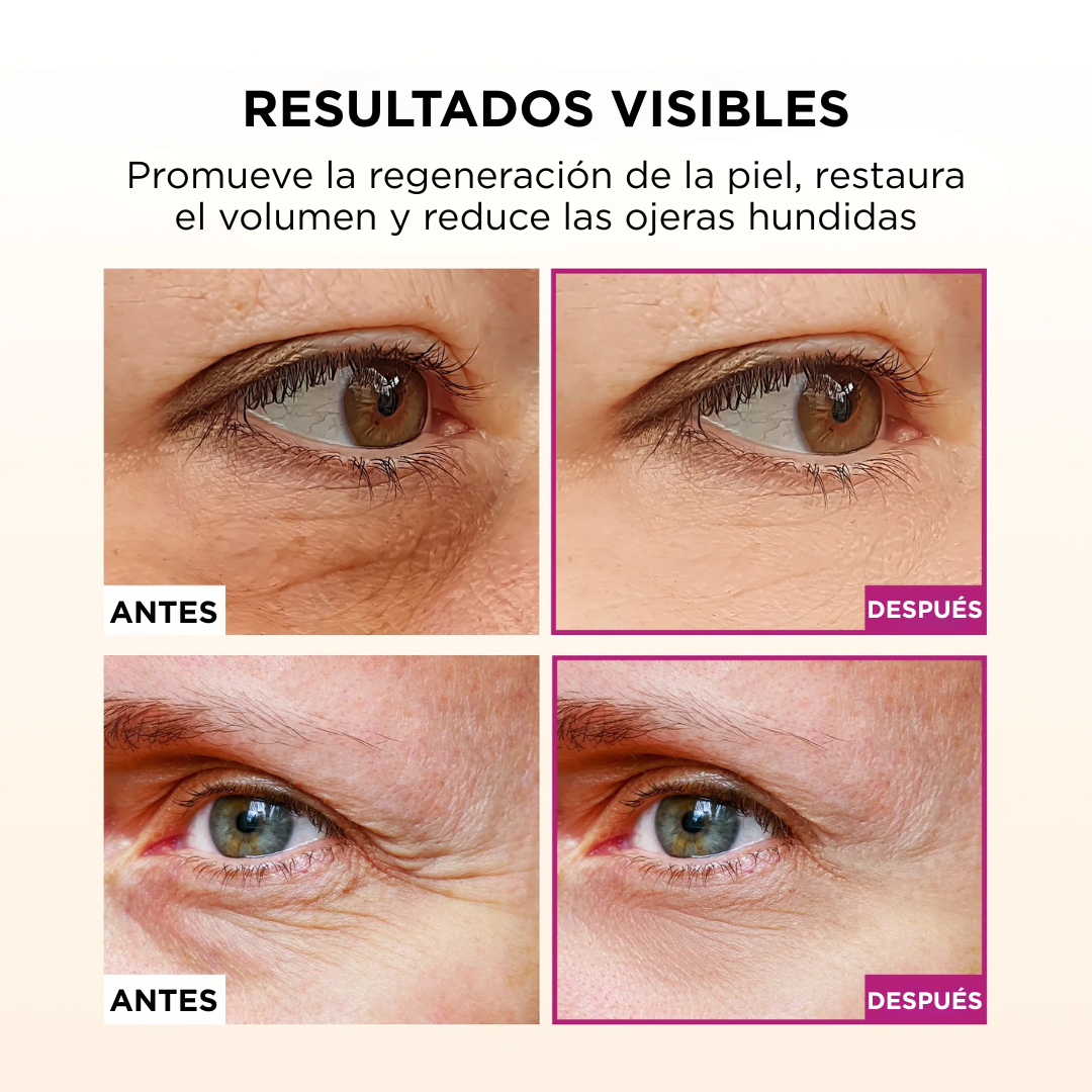 Pack Rejuvenecedor para Ojos – Bálsamo Lifting + Parches Reafirmantes