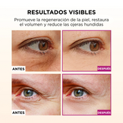 Pack Rejuvenecedor para Ojos – Bálsamo Lifting + Parches Reafirmantes