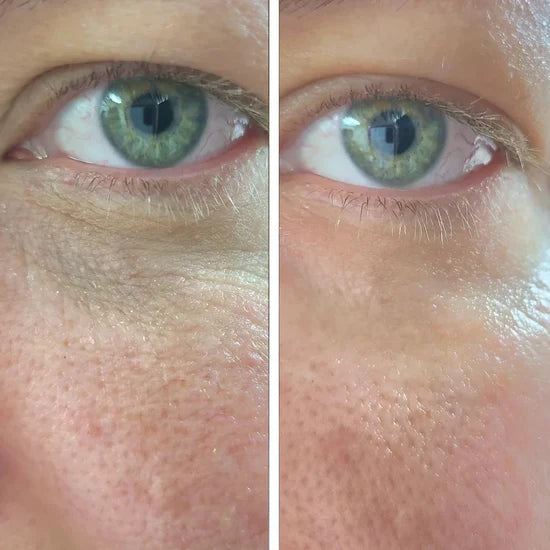 before_after_volufiline.webp