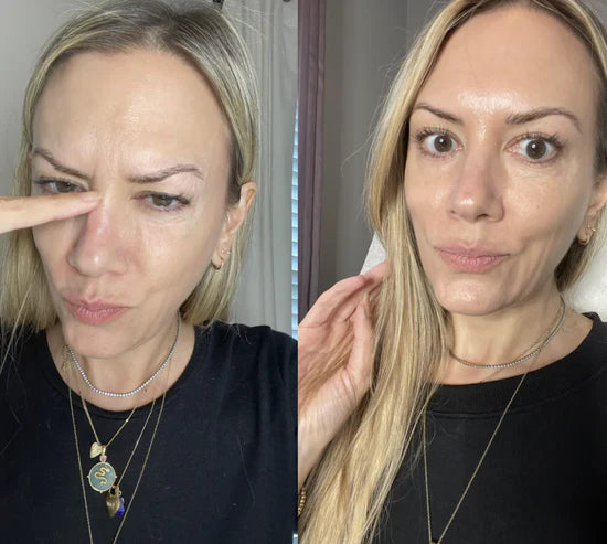 before_after_volufiline_best_2.webp