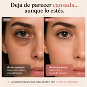 MIRAE™ Kit Tratamiento Completo — Corrector + BB Cream SPF 42 + Parches de Colágeno