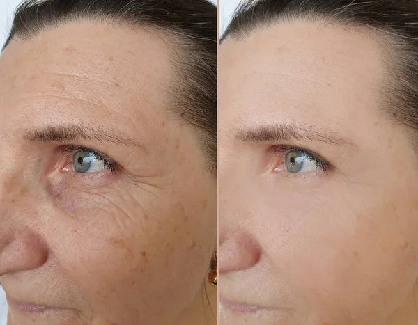 depositphotos_438230516-stock-photo-woman-face-wrinkles-treatment_1_3d76015f-4dba-4faf-97cd-036b4949233a.jpg