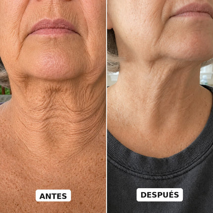 SISTEMA DOBLE NAD⁺® Reafirmante de Cuello y Papada