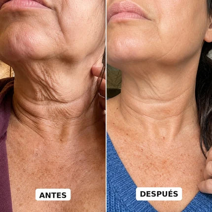 Sérum EQQUALBERRY® Reafirmante de Cuello y Papada