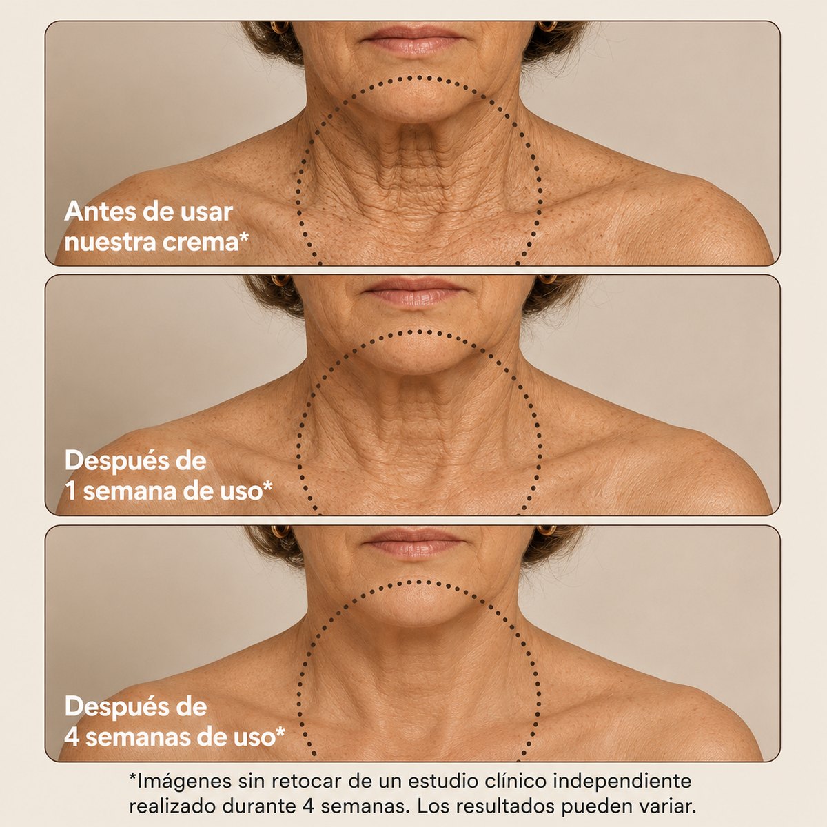 Antes y después del cuello: antes de usar la crema, tras 1 semana y tras 4 semanas de uso