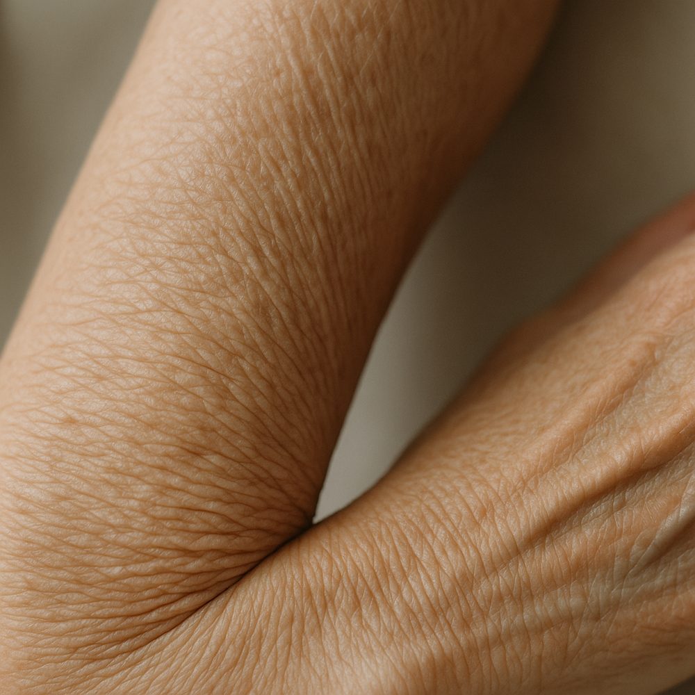 Detalle de piel crepé, fina y arrugada como papel, en el brazo