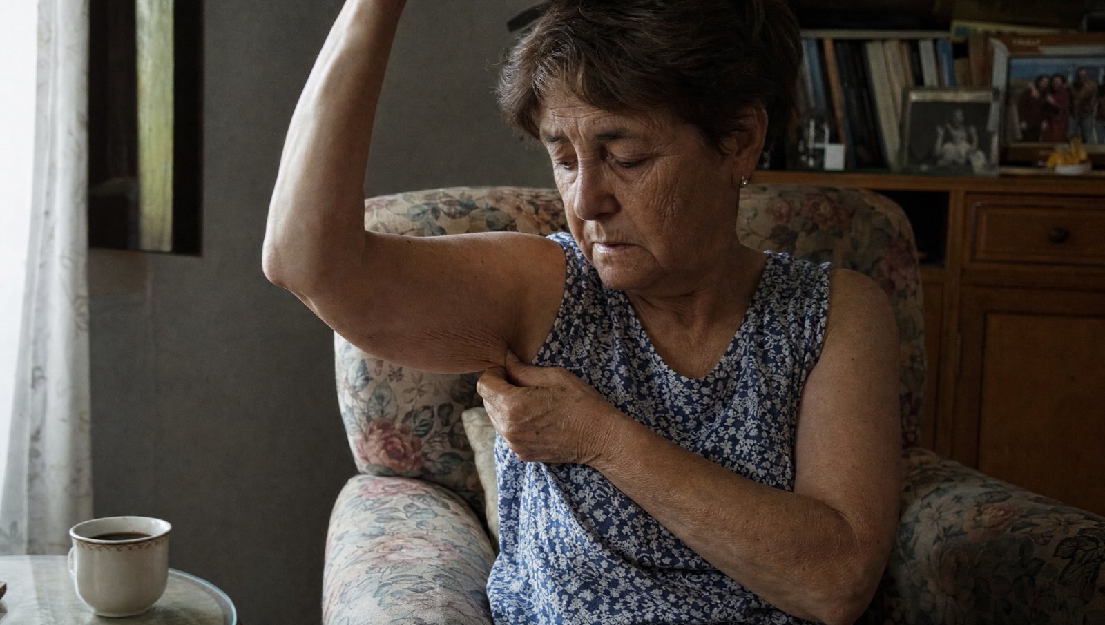 Mujer mayor sentada en un sillón, mirándose con preocupación la piel blanda de debajo del brazo