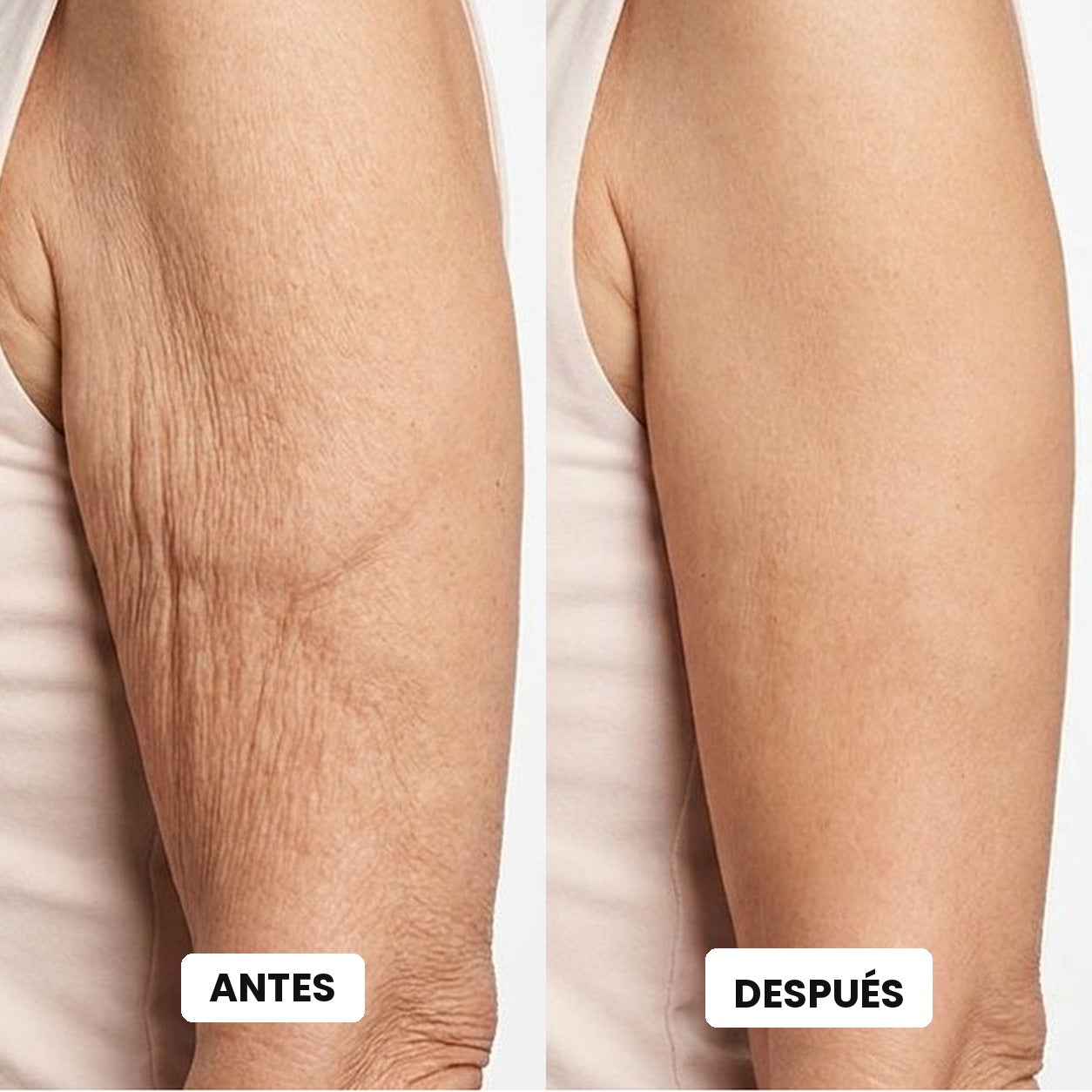 Antes y después en la piel del brazo