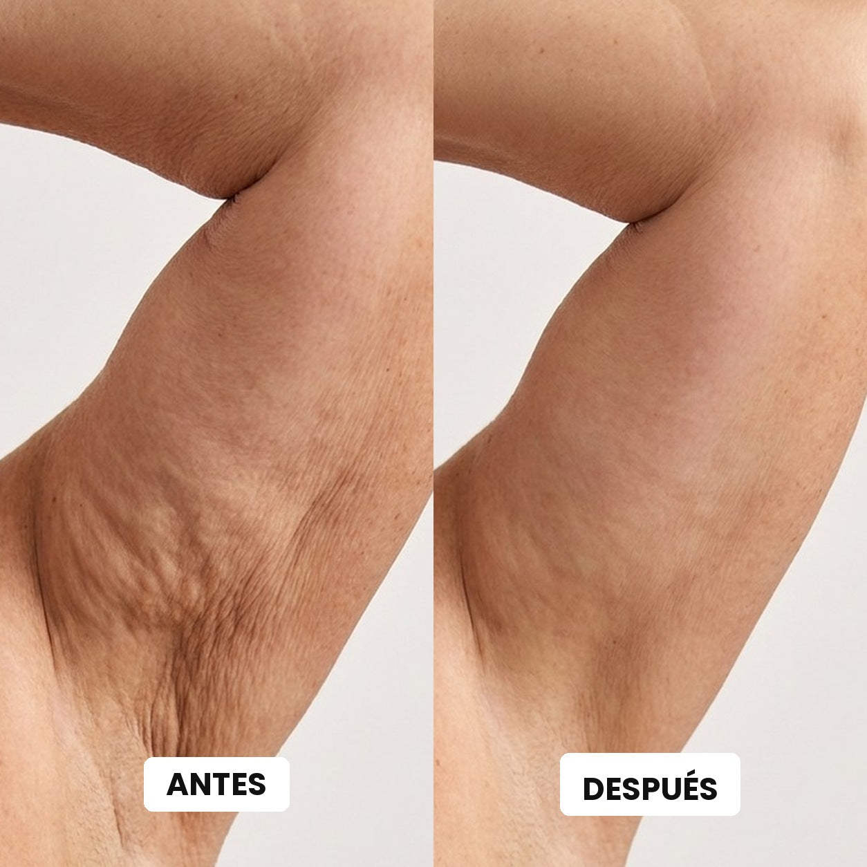 Antes y después en la piel del brazo