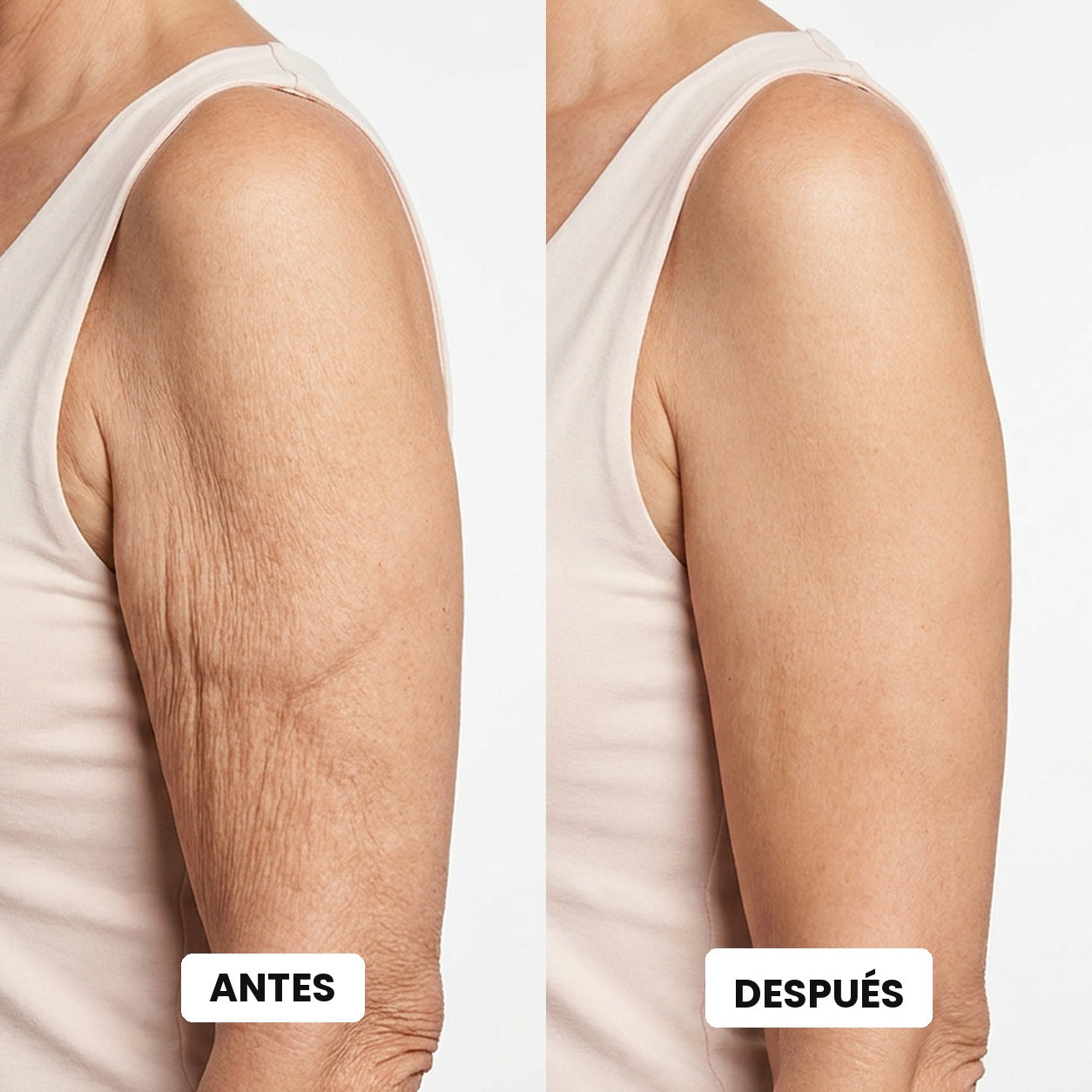 Antes y después en la piel del brazo