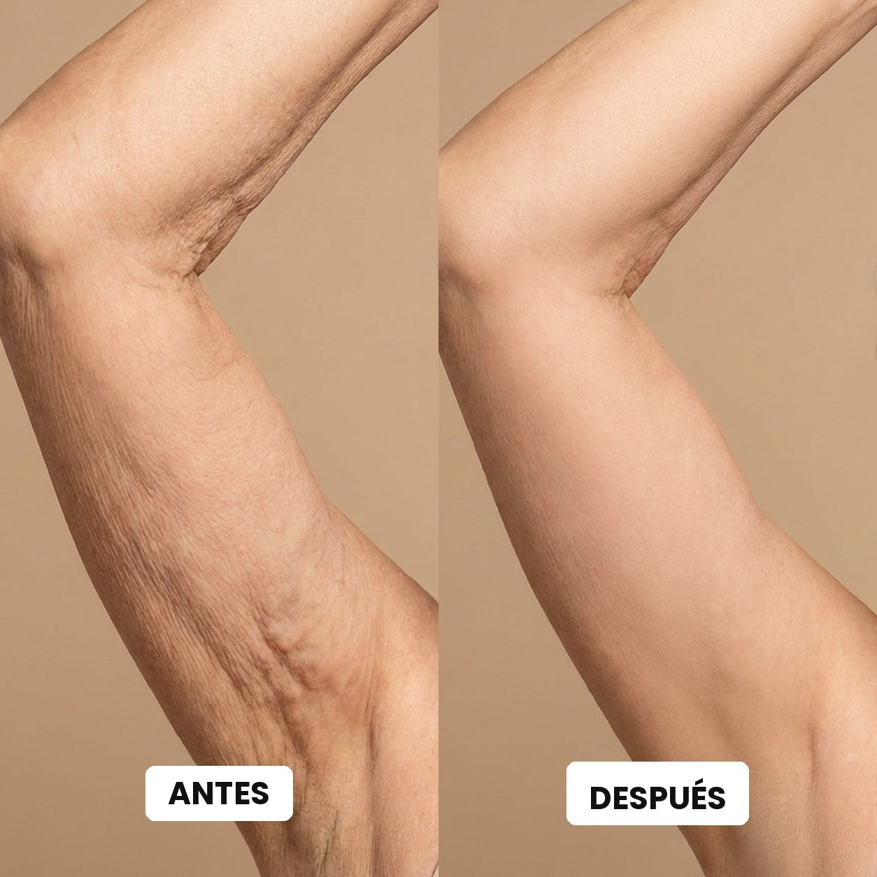 Antes y después en la piel del brazo