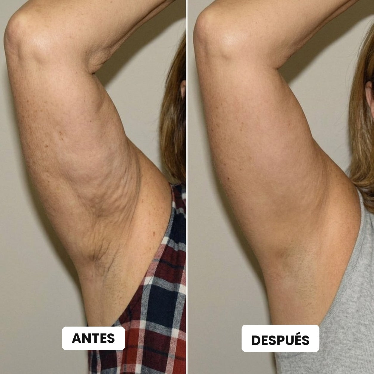 Antes y después en la piel del brazo