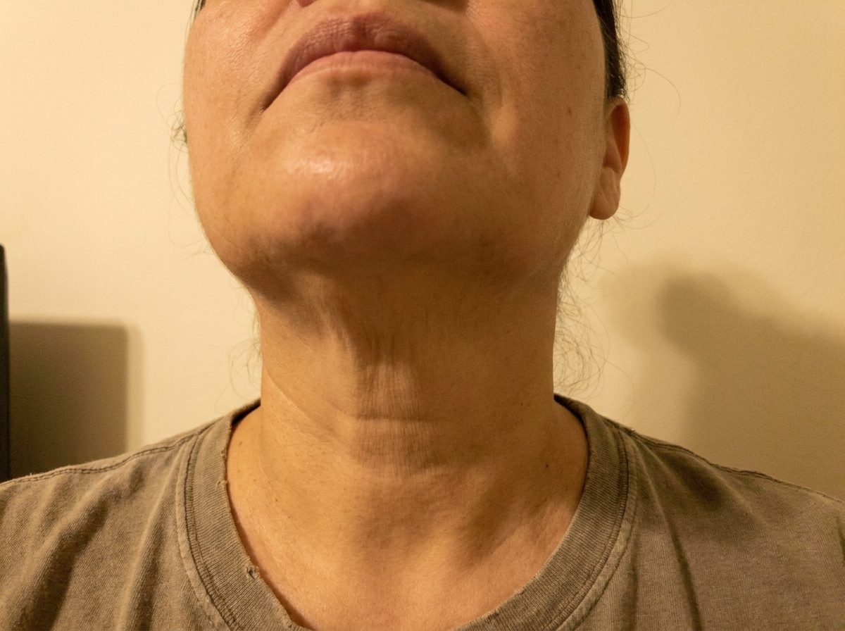 Foto casera del cuello y la mandíbula hecha con el celular en casa